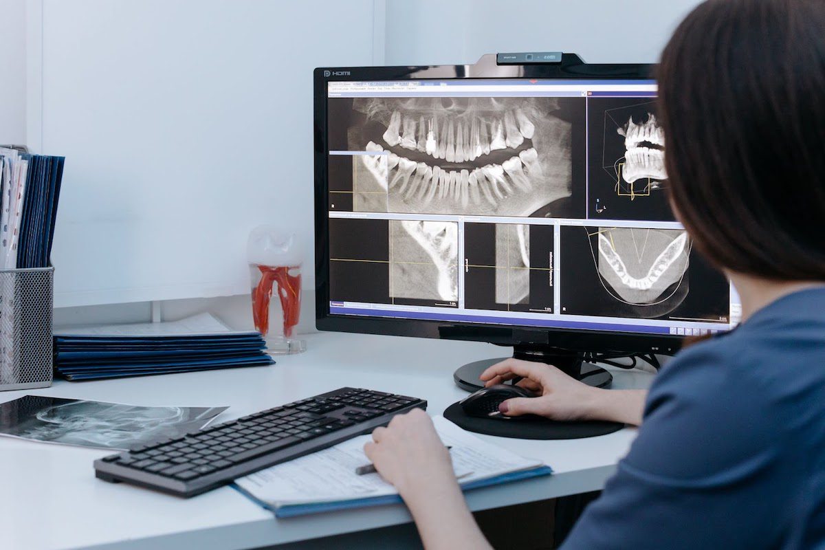 A person looking at dental x-rays on a computer screen